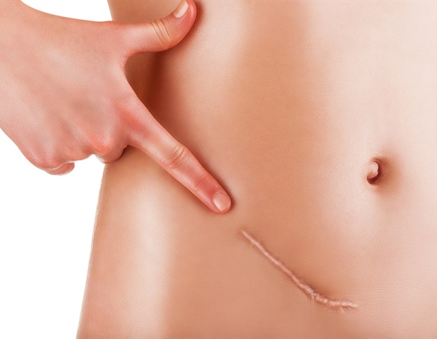 ������������� UVA ������� 700 000 �������� �� ������������� ������������ ���� ��������