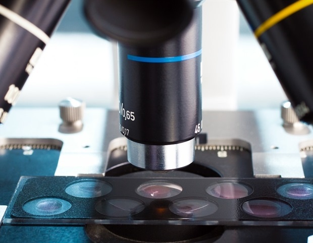 ����-�� �������� ��������� NPFFR1 � ���������� ������ ������ �������